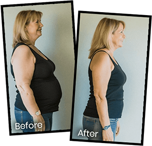 Before and after weight loss comparison photo of a woman