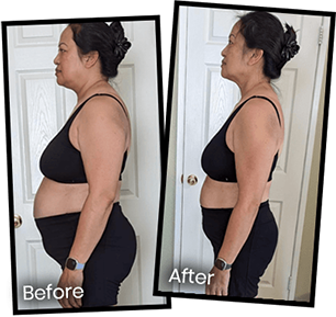 Before and after photo showing the physical transformation of a woman